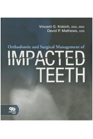 Orthodontic and Surgical Management of Impacted Teeth, 1st Edition