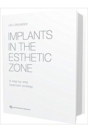Implants in the Esthetic Zone: A Step-by-Step Treatment Strategy, 1st Edition