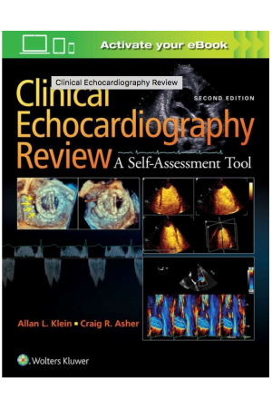 Clinical Echocardiography Review, 2nd Edition