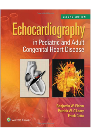 Echocardiography in Pediatric and Adult Congenital Heart Disease, 2nd Edition
