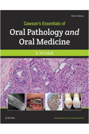 Cawson's Essentials of Oral Pathology and Oral Medicine, International Edition, 9th Edition