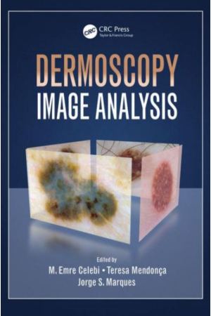 Dermoscopy Image Analysis