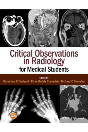 Critical Observations in Radiology for Medical Students, 1st Edition