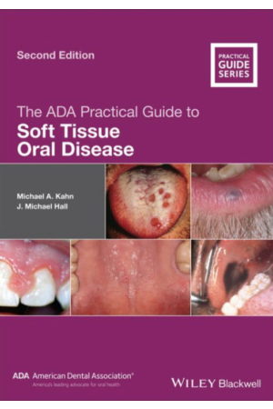 The ADA Practical Guide to Soft Tissue Oral Disease, 2nd Edition