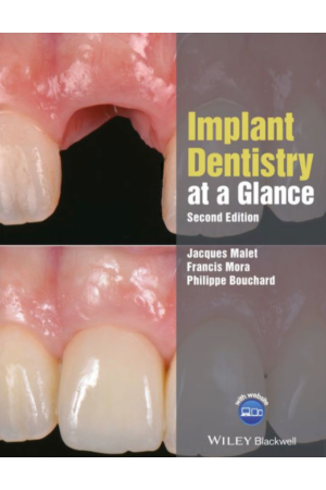 Implant Dentistry at a Glance, 2nd Edition