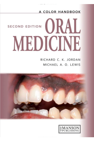 Oral Medicine, 2nd Edition