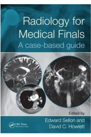 Radiology for Medical Finals: A case-based guide, 1st Edition
