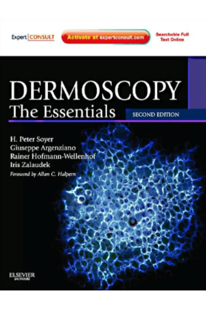 Dermoscopy: The Essentials: Expert Consult - Online and Print, 2nd Edition