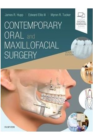 Contemporary Oral and Maxillofacial Surgery, 7th Edition