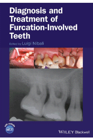 Diagnosis and Treatment of Furcation-Involved Teeth, 1st Edition