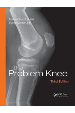 The Problem Knee, 3rd Edition