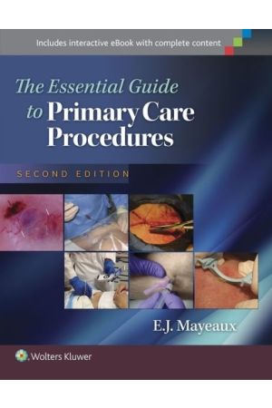 Essential Guide to Primary Care Procedures, 2nd Edition