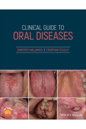 Clinical Guide to Oral Diseases-9781119328117