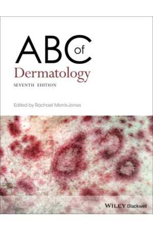 ABC of Dermatology - 9781119488989 