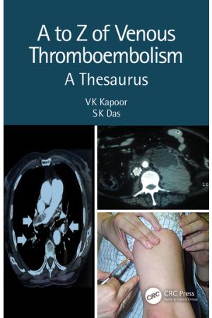 A to Z of Venous Thromboembolism: A Thesaurus