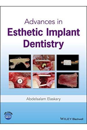 Advances in Esthetic Implant Dentistry, 1st Edition