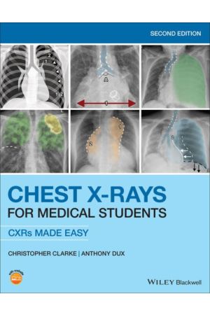 Chest-X-Rays-for-Medical-Students-CXRs-Made-Easy-9781119504153.jpg