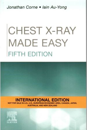 Chest X-Ray Made Easy, International Edition, 5th Edition