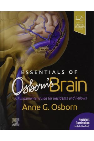 Essentials of Osborn's Brain: A Fundamental Guide for Residents and Fellows