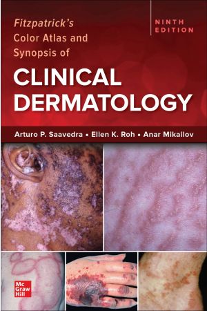 Fitzpatrick's Color Atlas and Synopsis of Clinical Dermatology, International Edition, 9th Edition
