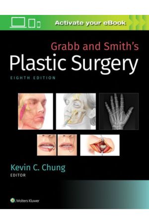 Grabb-and-Smiths-Plastic-Surgery-9781496388247