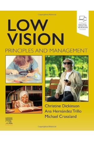 Low Vision: Principles and Management 