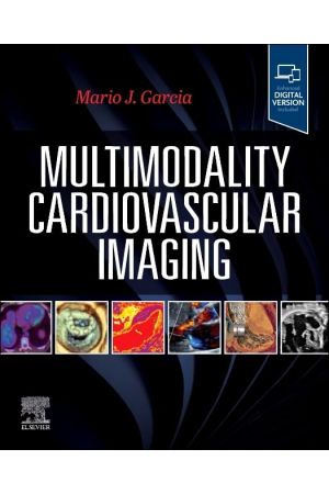 Multimodality Cardiovascular Imaging, 1st Edition