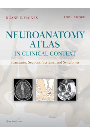 Neuroanatomy Atlas in Clinical Context: Structures, Sections, Systems, and Syndromes, 10th Edition, International Edition