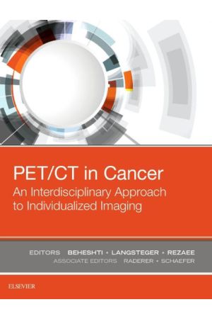 PET/CT in Cancer: An Interdisciplinary Approach to Individualized Imaging, 1st Edition