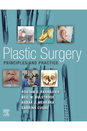 Plastic Surgery - Principles and Practice