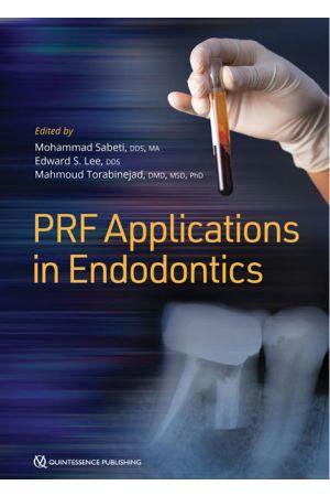 PRF-Applications-in-Endodontics-9780867158274