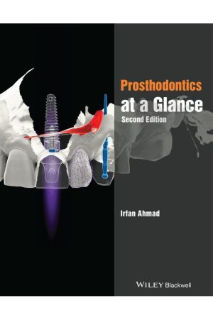 Prosthodontics at a Glance
