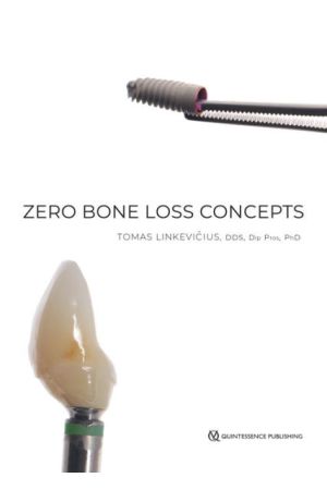 Zero-Bone-Loss-Concepts-9780867158342