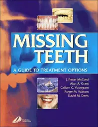 Missing Teeth: A Guide to Treatment Options