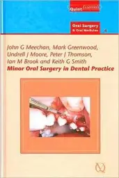 Minor Oral Surgery in Dental Practice