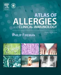 Atlas of Allergy and Clinical Immunology 3rd Edition