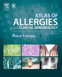 Atlas of Allergy and Clinical Immunology 3rd Edition