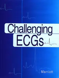 Challenging ECGs