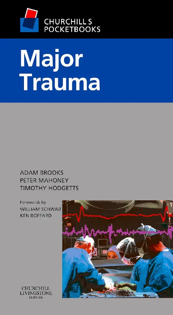 Churchill's Pocketbook of Major Trauma