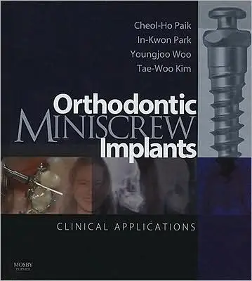 Orthodontic Miniscrew Implants