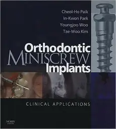 Orthodontic Miniscrew Implants