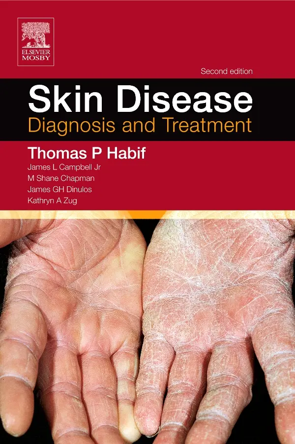 Skin Disease, 2nd Edition: Diagnosis and Treatment