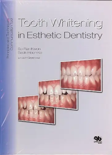 Tooth Whitening in Esthetic Dentistry: Principles and Techniques, 1st Edtion