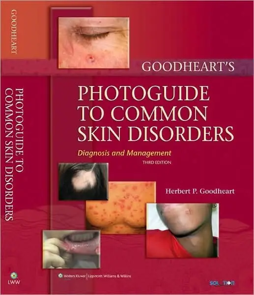 Goodheart's Photoguide to Common Skin Disorders Diagnosis and Management, 3rd edtion