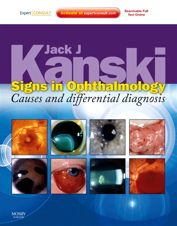 Signs in Ophthalmology: Causes and Differential Diagnosis Expert Consult - Online and Print