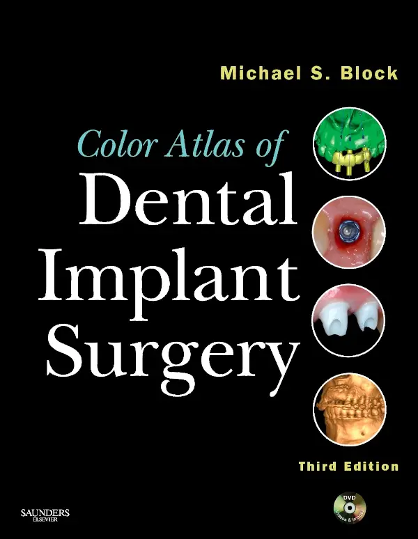 Color Atlas of Dental Implant Surgery, 3rd Edition
