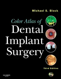 Color Atlas of Dental Implant Surgery, 3rd Edition
