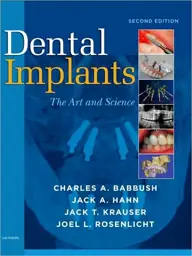 Dental Implants: The Art and Science, 2nd Edition