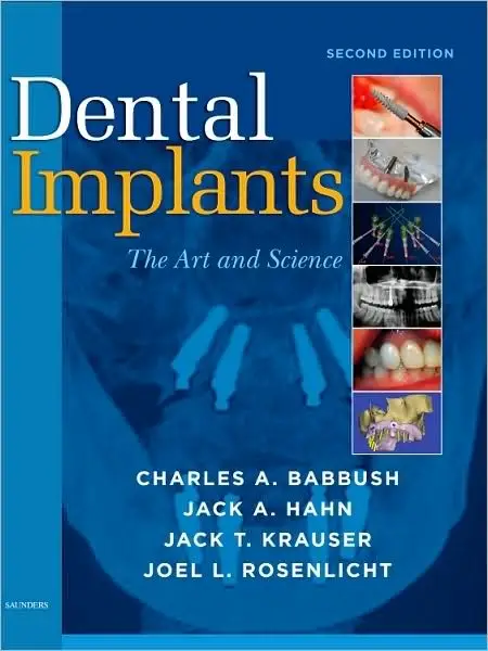 Dental Implants: The Art and Science, 2nd Edition