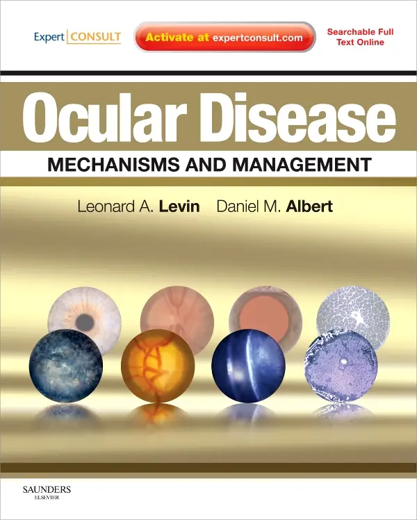 Ocular Disease: Mechanisms and Management: Expert Consult - Online and Print